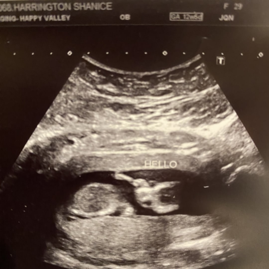Photo shared by Shanice for their Babylist baby registry.