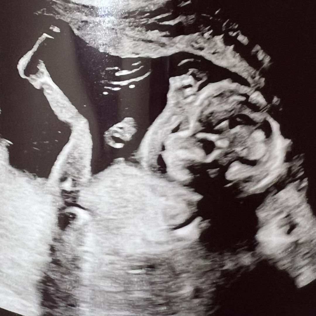 Photo shared by Chelsea for their Babylist baby registry.