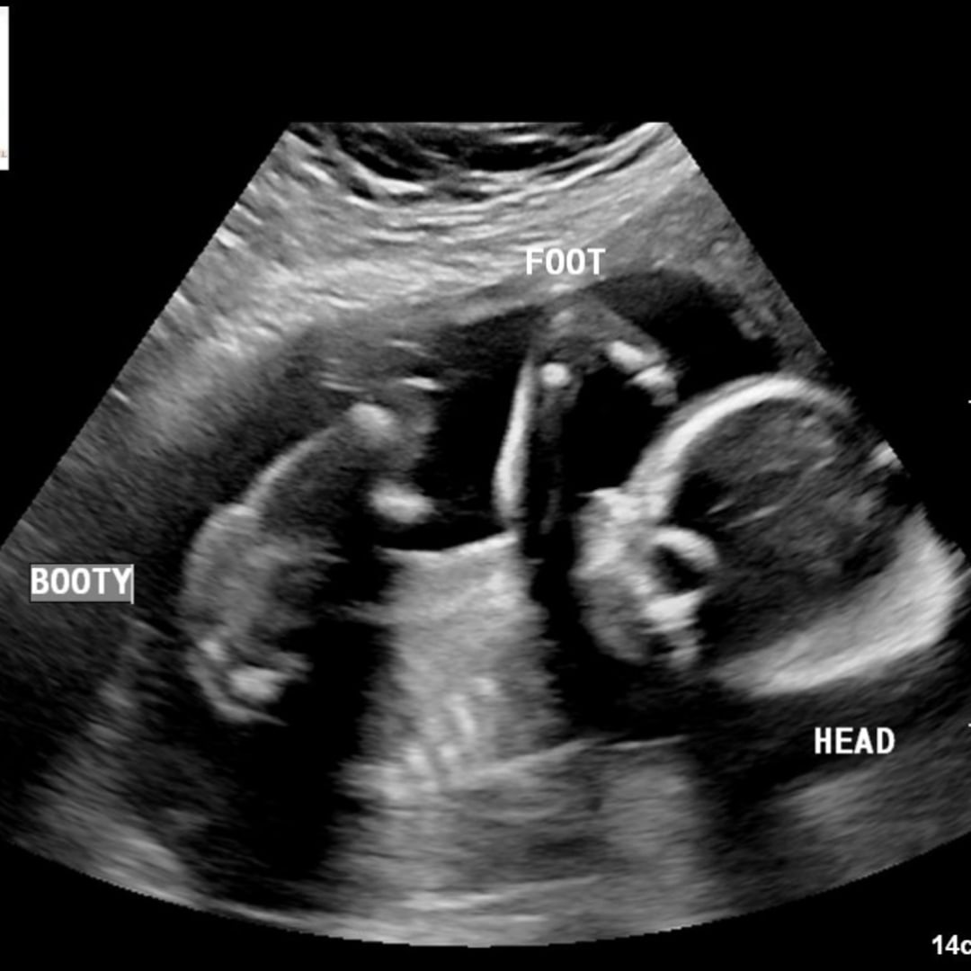 Photo shared by Audra for their Babylist baby registry.