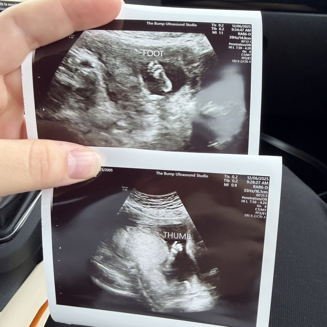 Photo shared by Bailey for their Babylist baby registry.