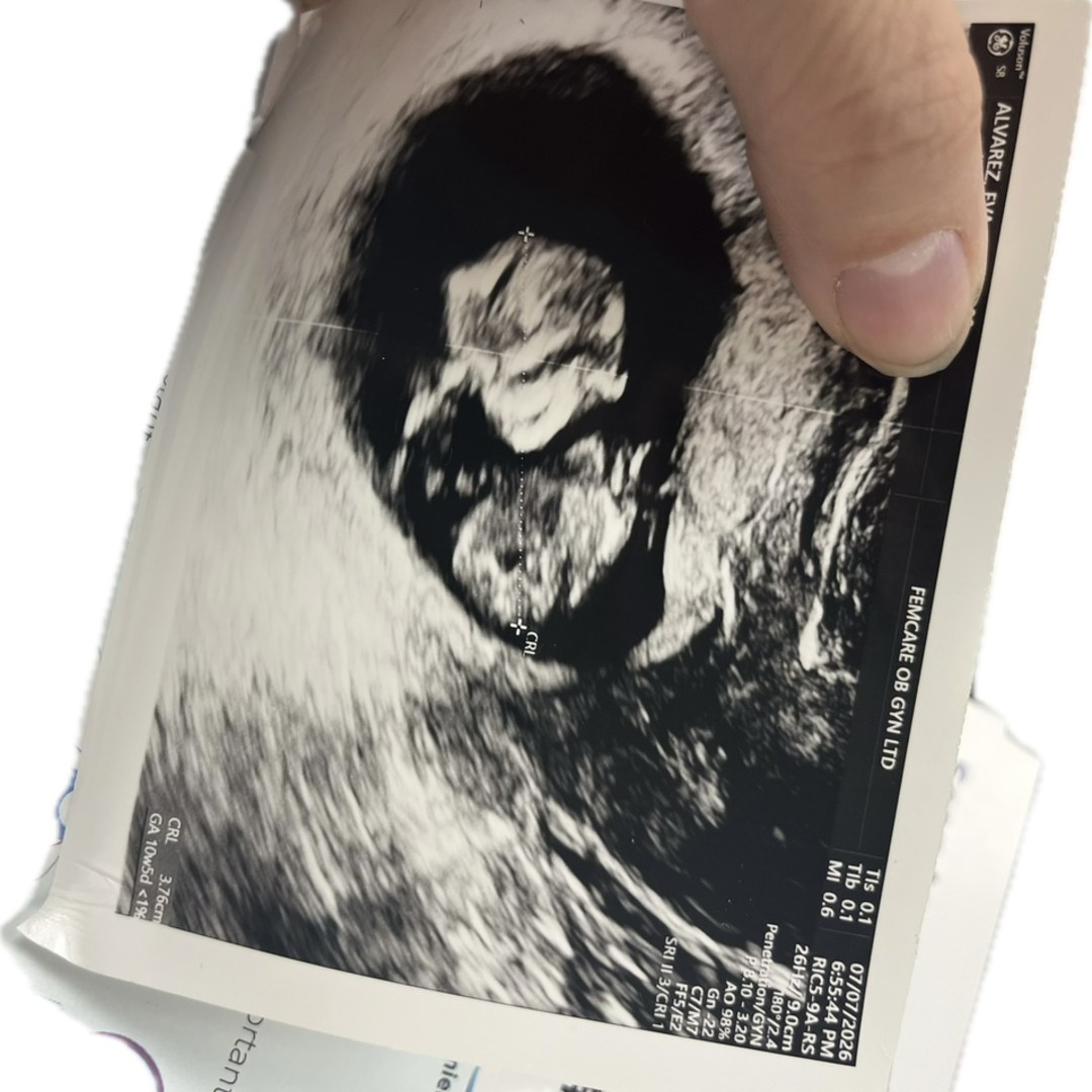 Photo shared by Eva for their Babylist baby registry.