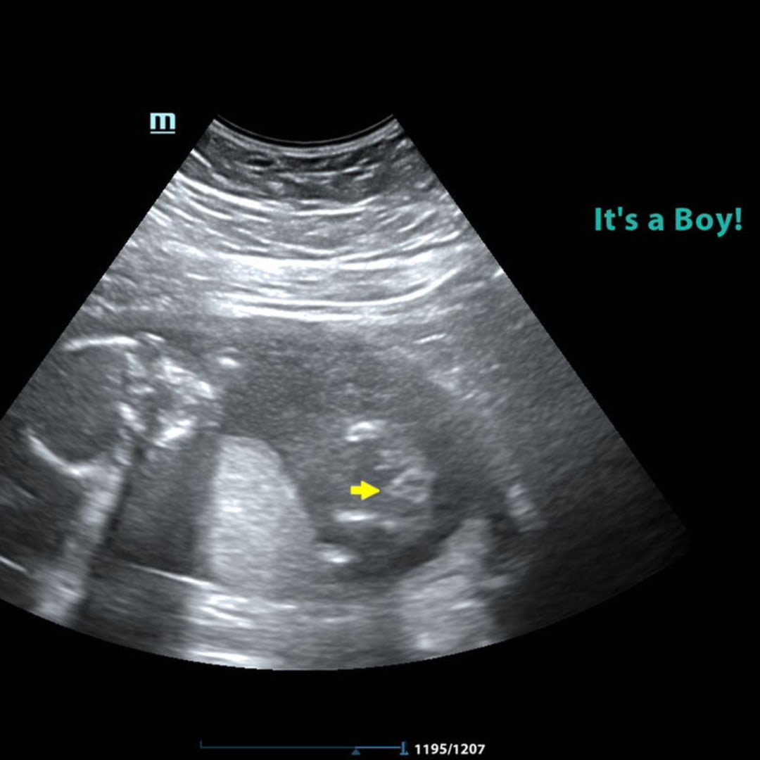 Photo shared by Molly for their Babylist baby registry.