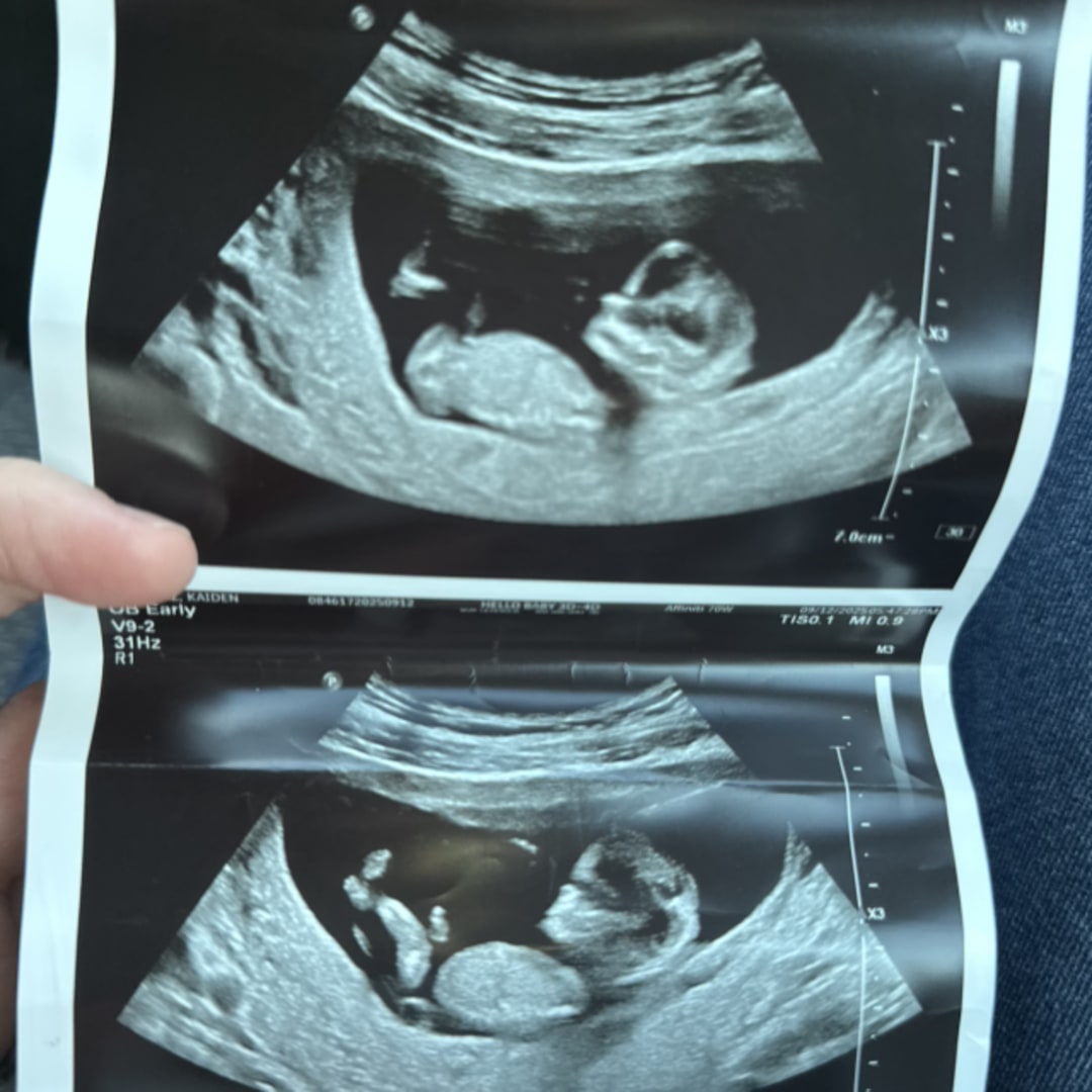 Photo shared by Kaiden for their Babylist baby registry.