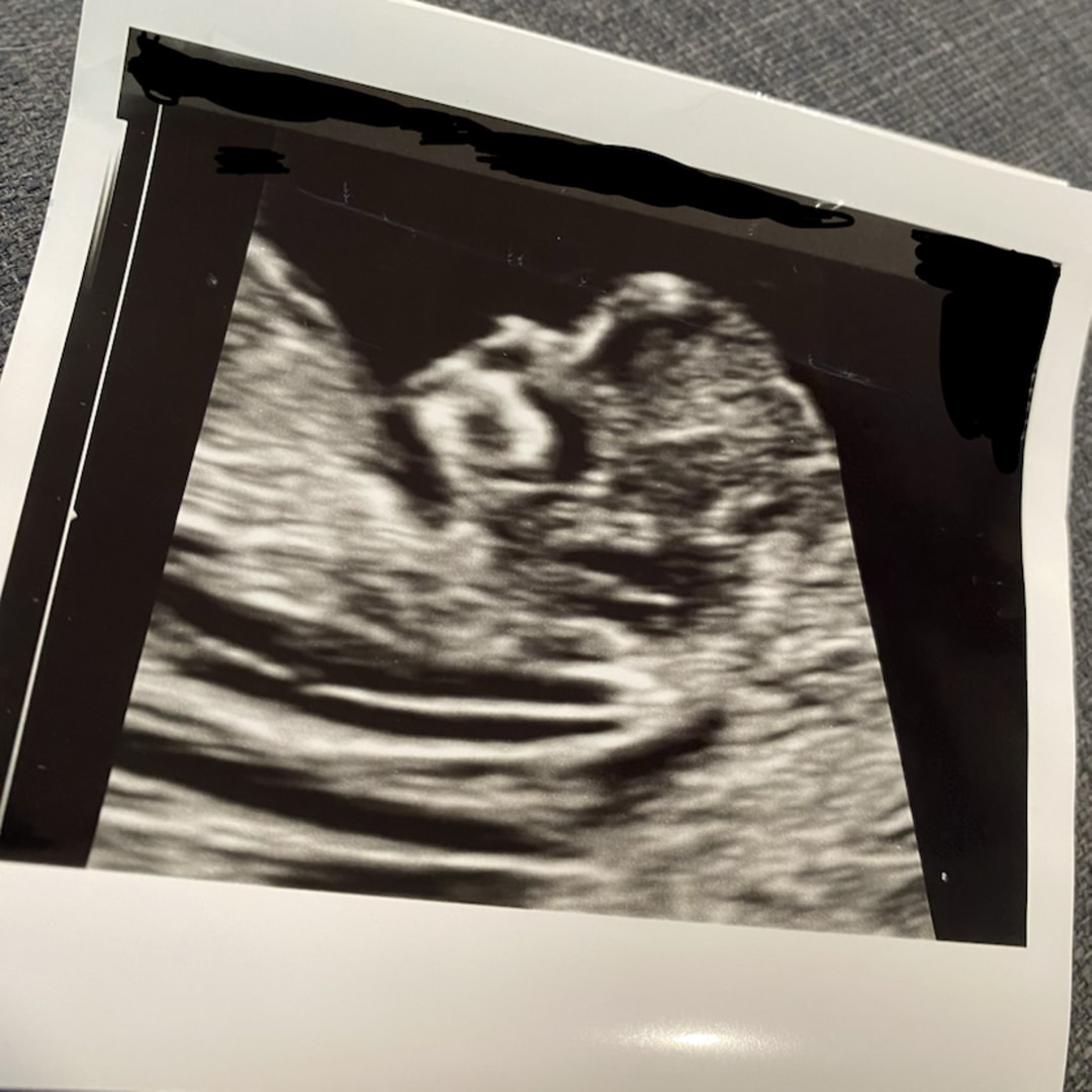 Photo shared by Beth for their Babylist baby registry.
