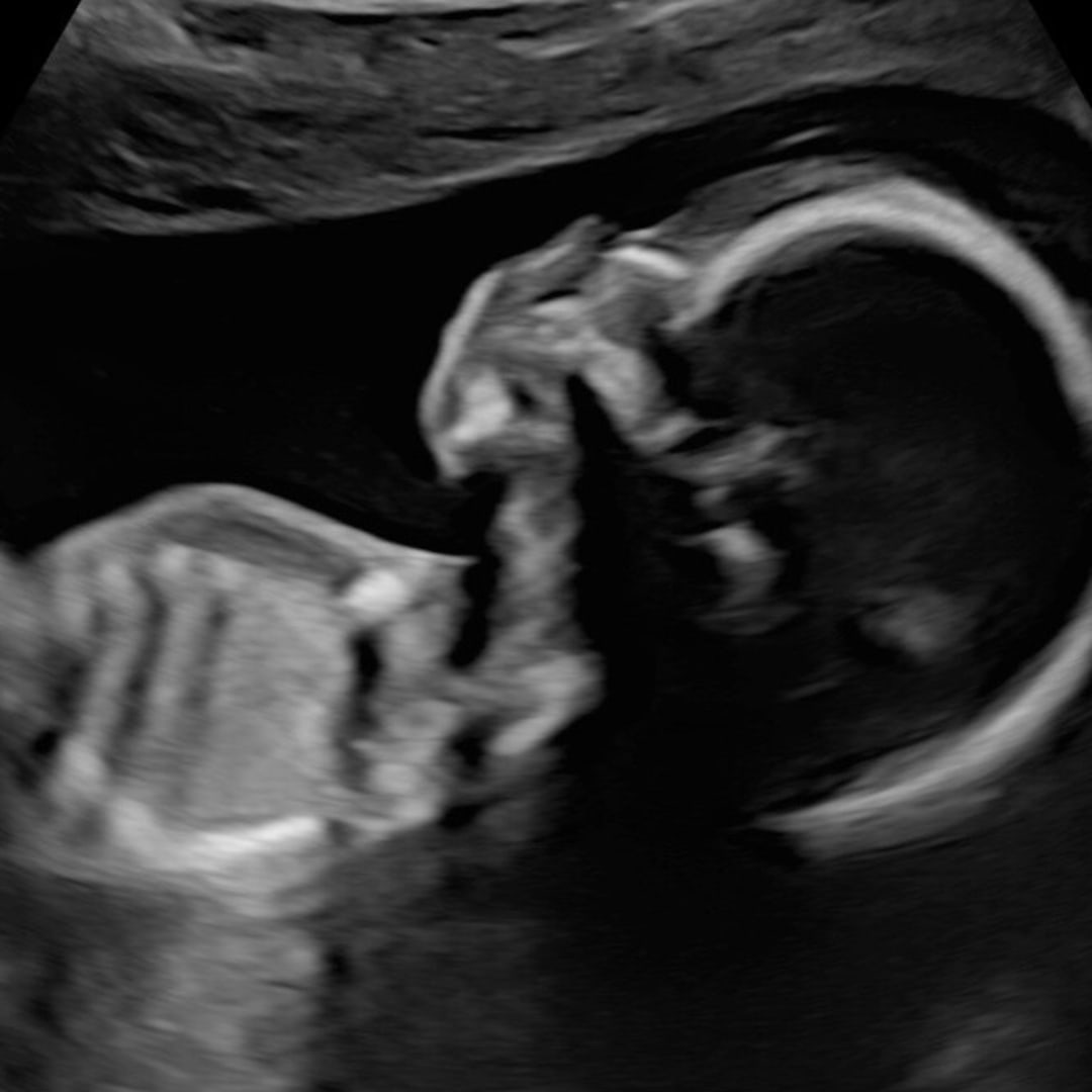 Photo shared by Natalie for their Babylist baby registry.