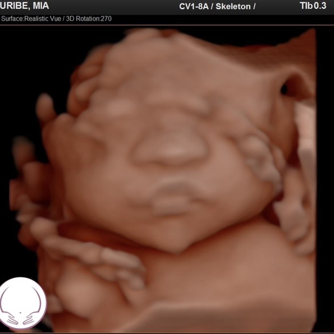 Photo shared by Mia for their Babylist baby registry.