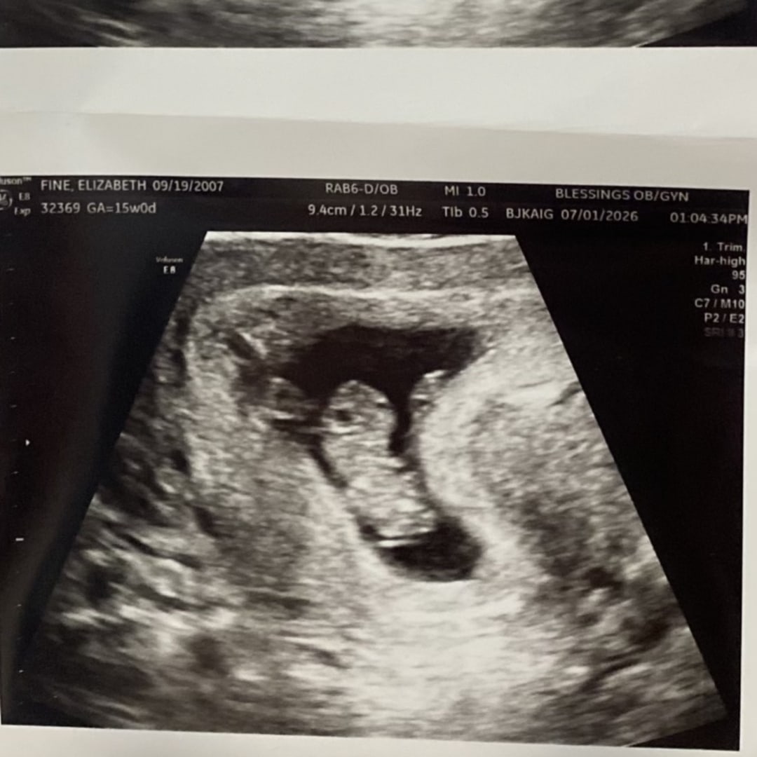 Photo shared by Elizabeth for their Babylist baby registry.
