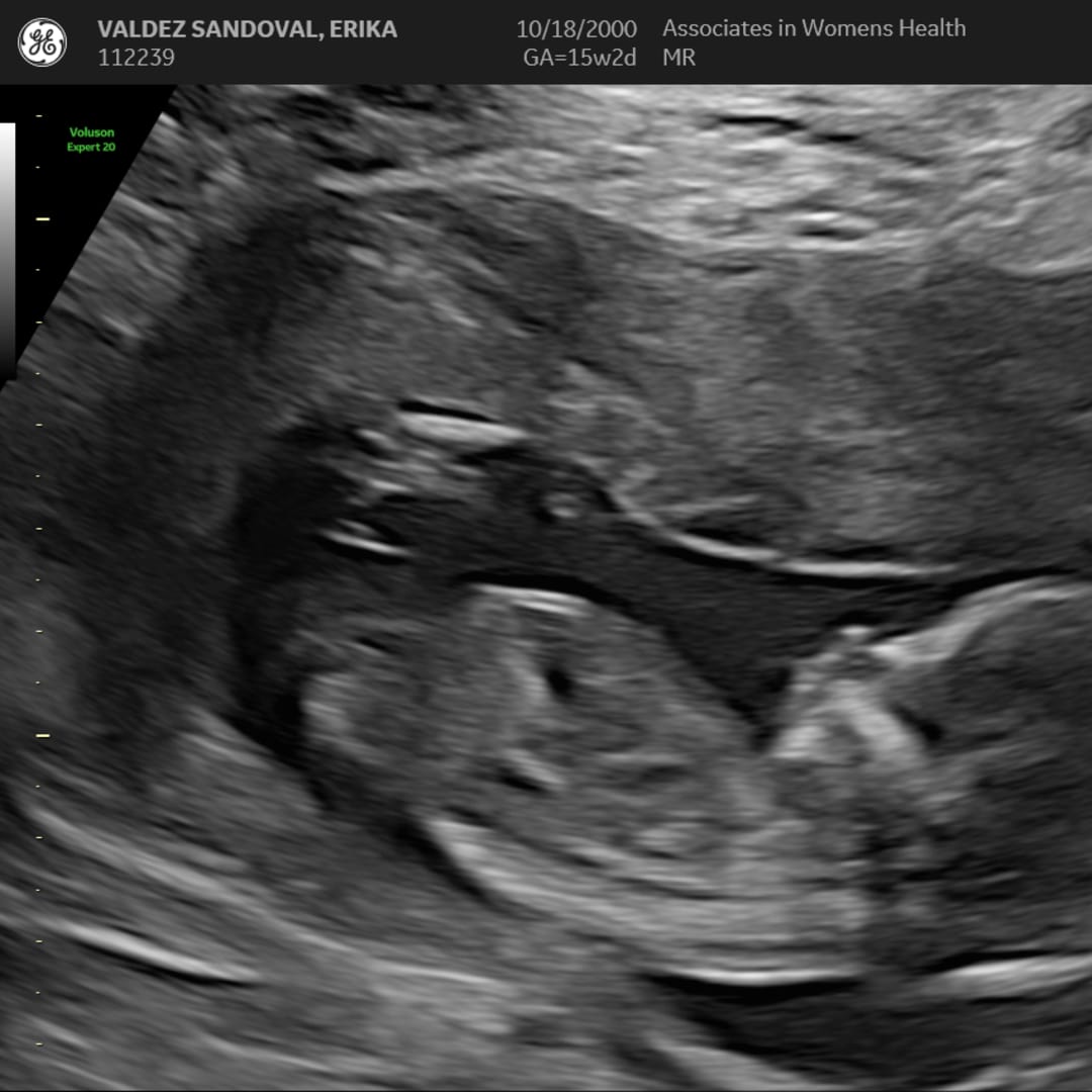 Photo shared by Erika for their Babylist baby registry.