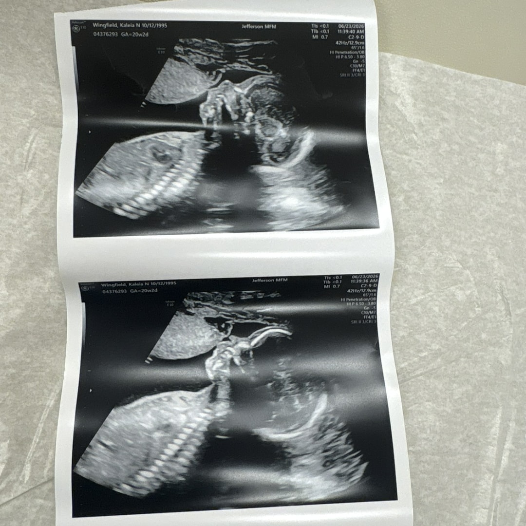 Photo shared by Kaleia for their Babylist baby registry.