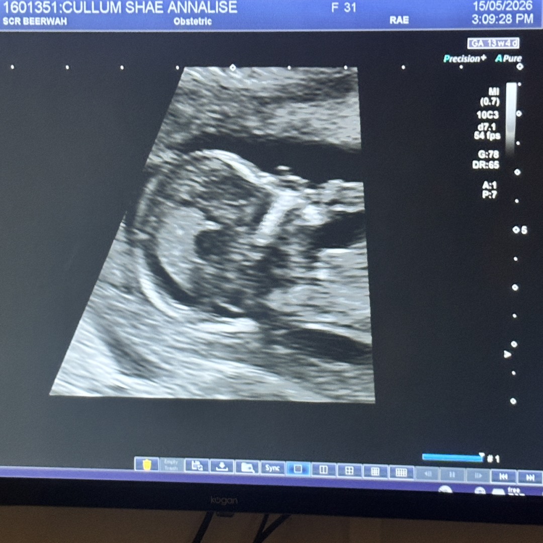 Photo shared by Shae for their Babylist baby registry.