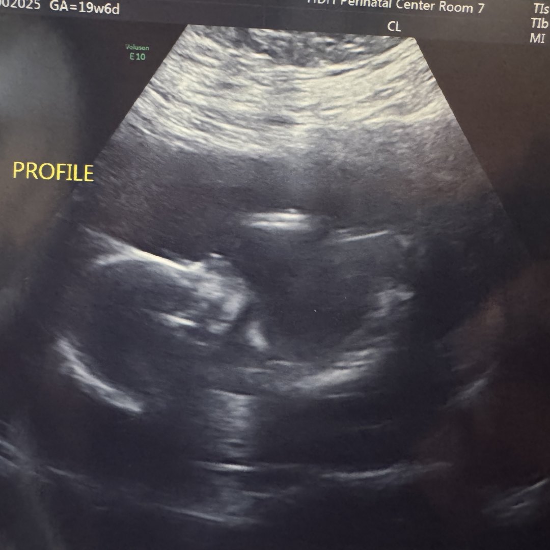 Photo shared by Simone for their Babylist baby registry.