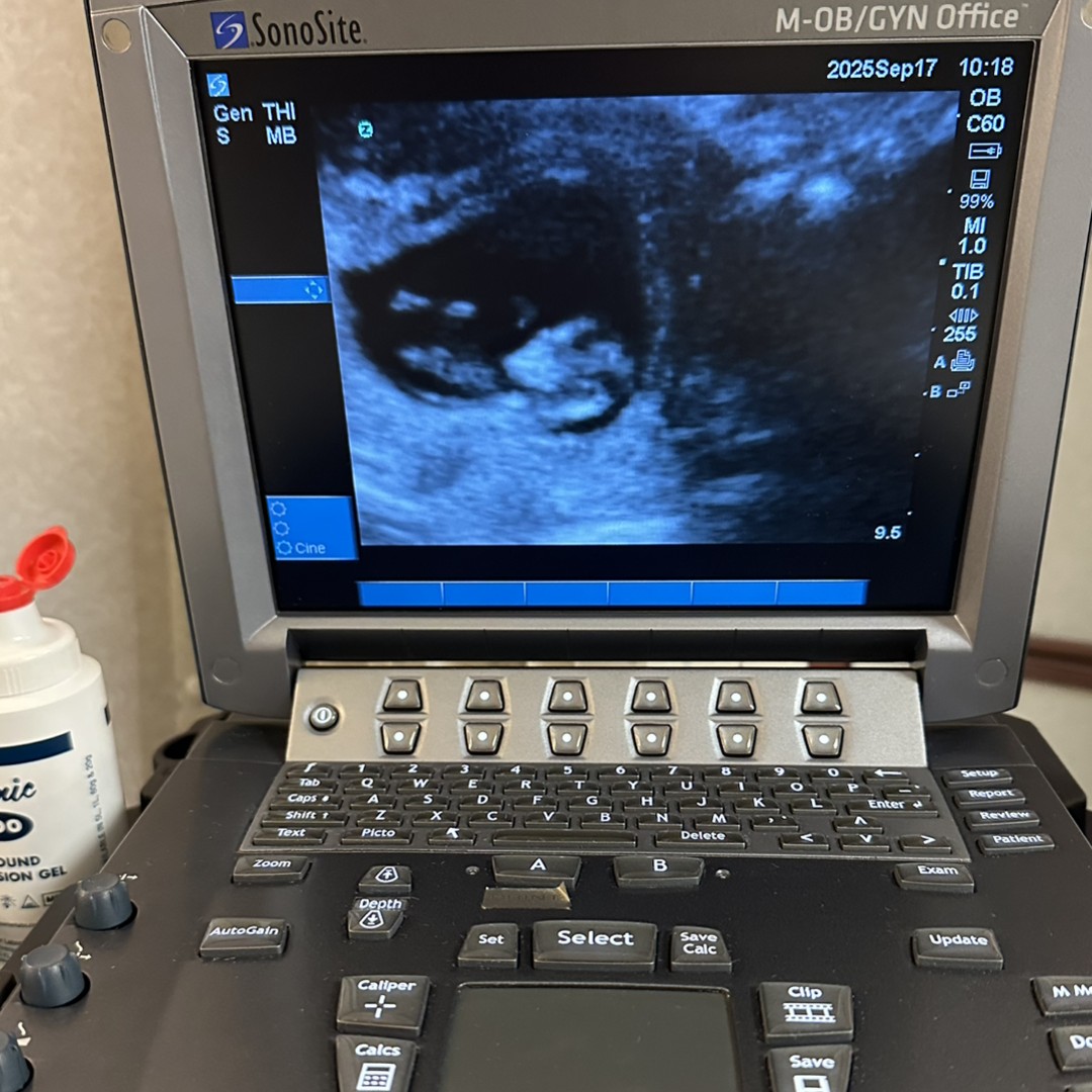 Photo shared by Lydia for their Babylist baby registry.