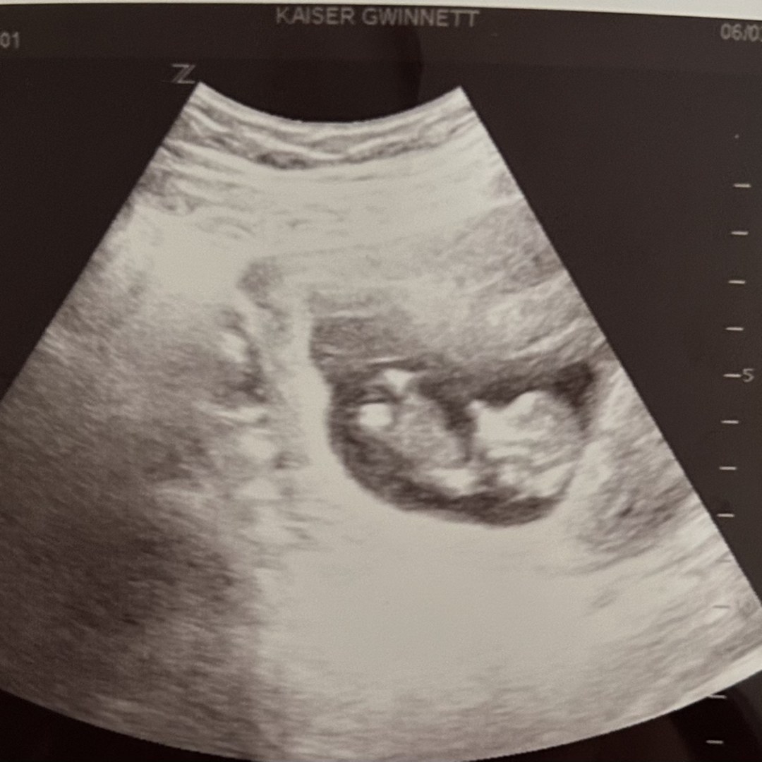 Photo shared by Linda for their Babylist baby registry.