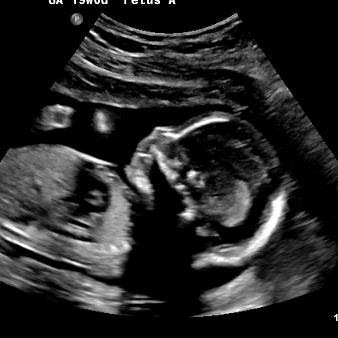 Photo shared by Alyssa for their Babylist baby registry.