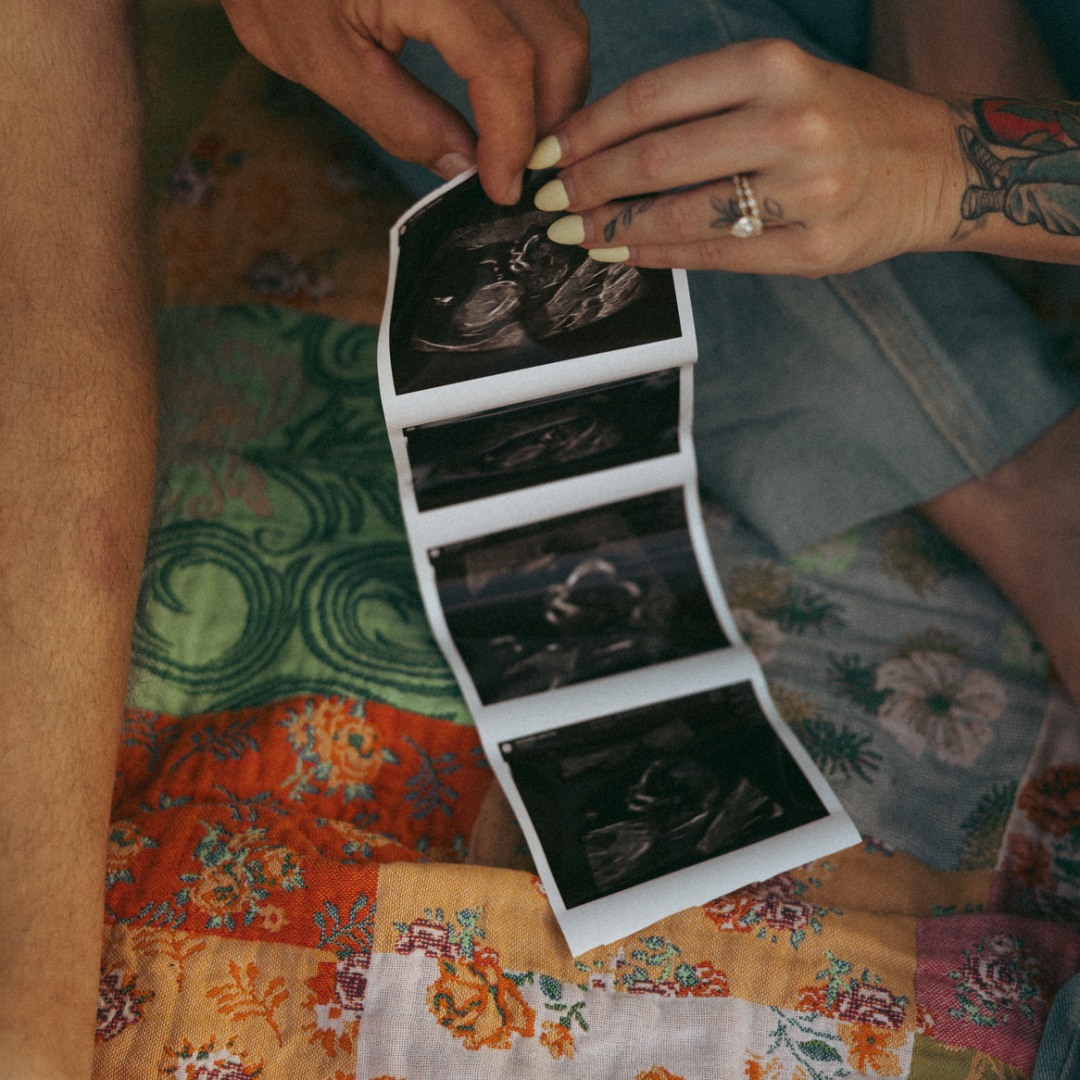 Photo shared by Kristin for their Babylist baby registry.