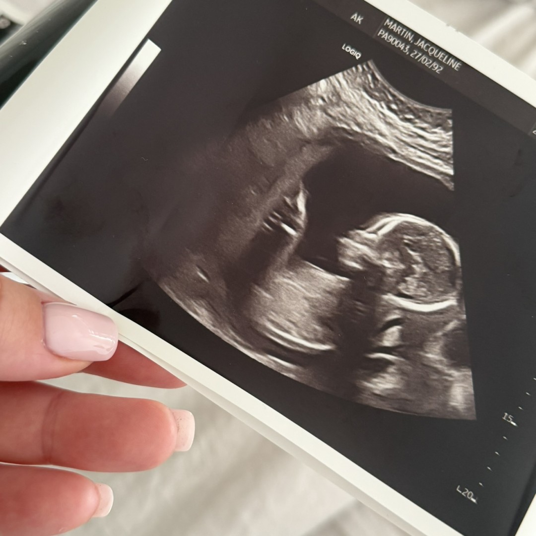 Photo shared by Jacqueline for their Babylist baby registry.