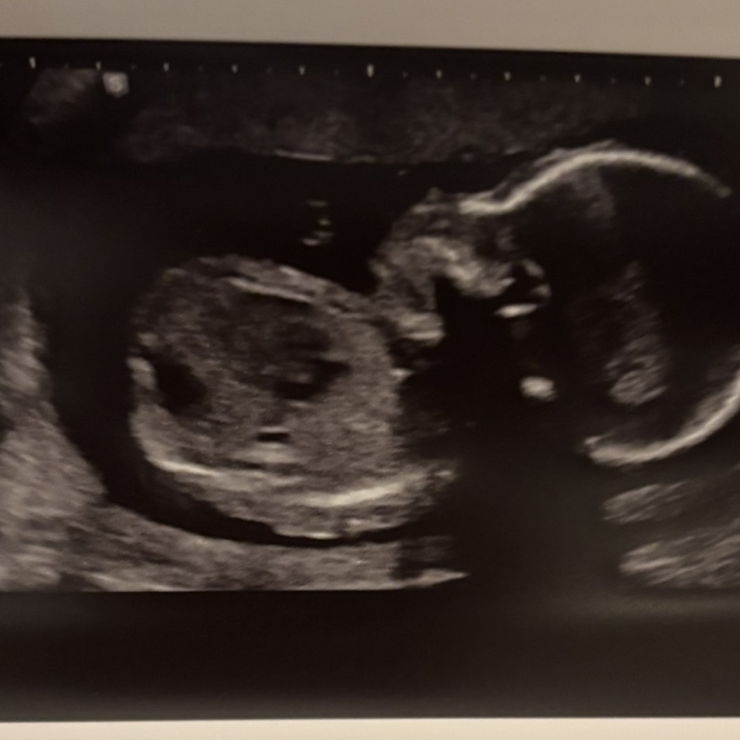 Photo shared by Angela for their Babylist baby registry.