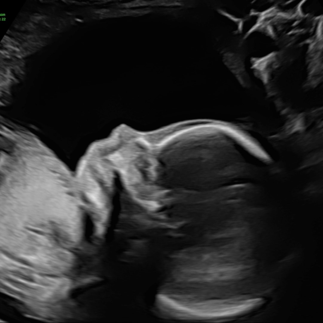 Photo shared by Morgan for their Babylist baby registry.