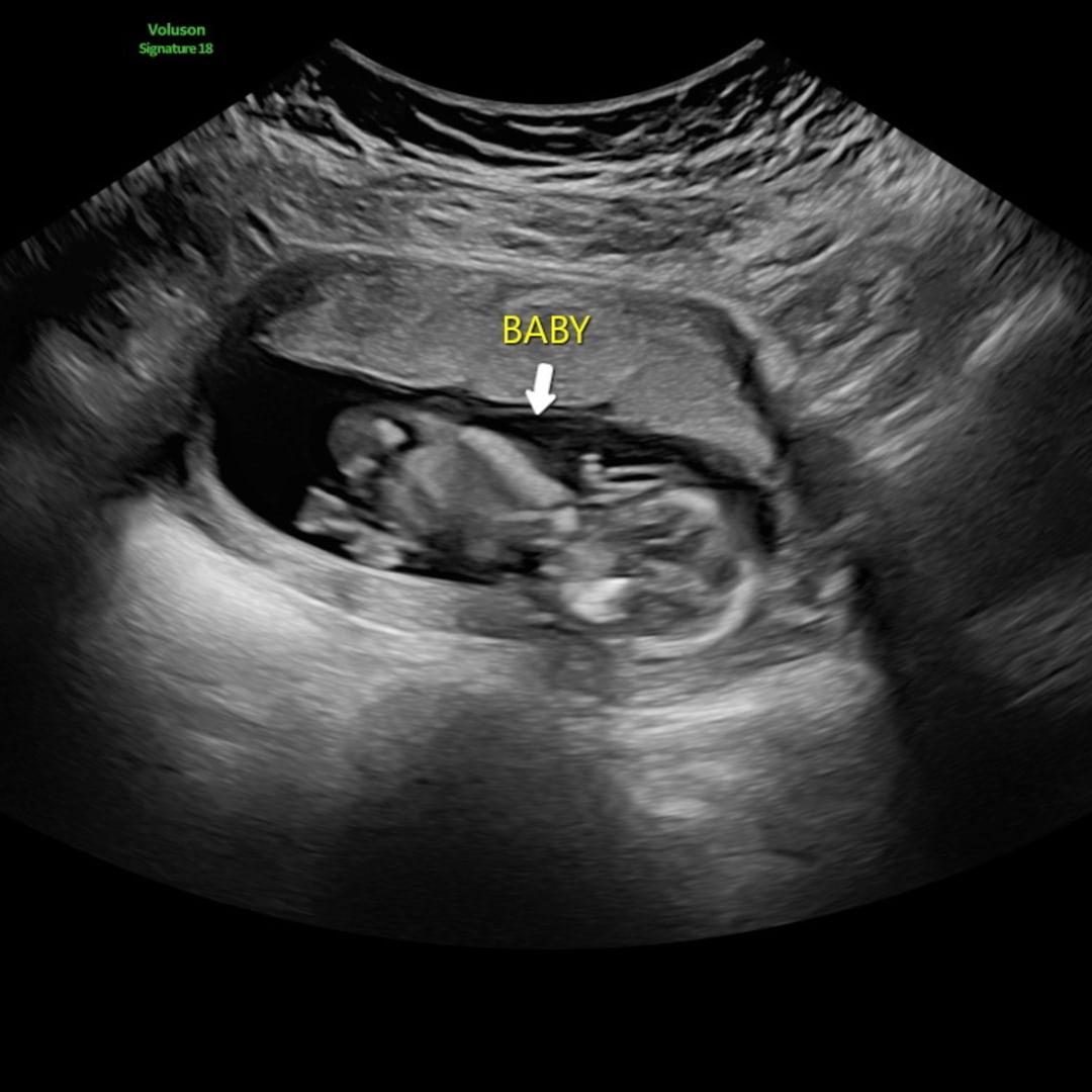 Photo shared by Kenzie for their Babylist baby registry.