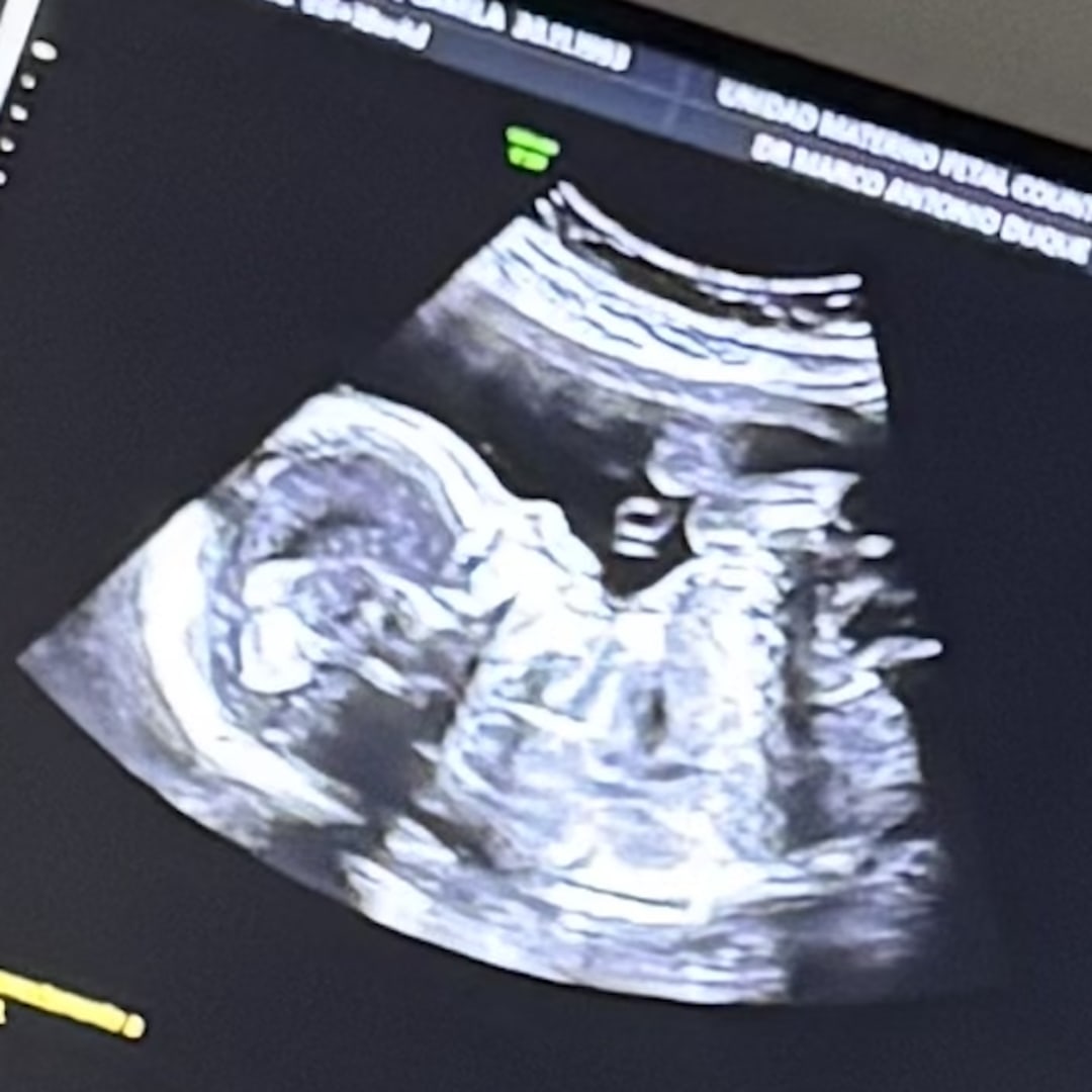 Photo shared by Camila for their Babylist baby registry.