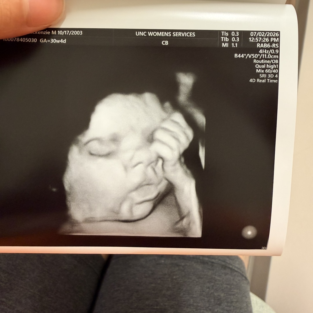 Photo shared by Mackenzie for their Babylist baby registry.