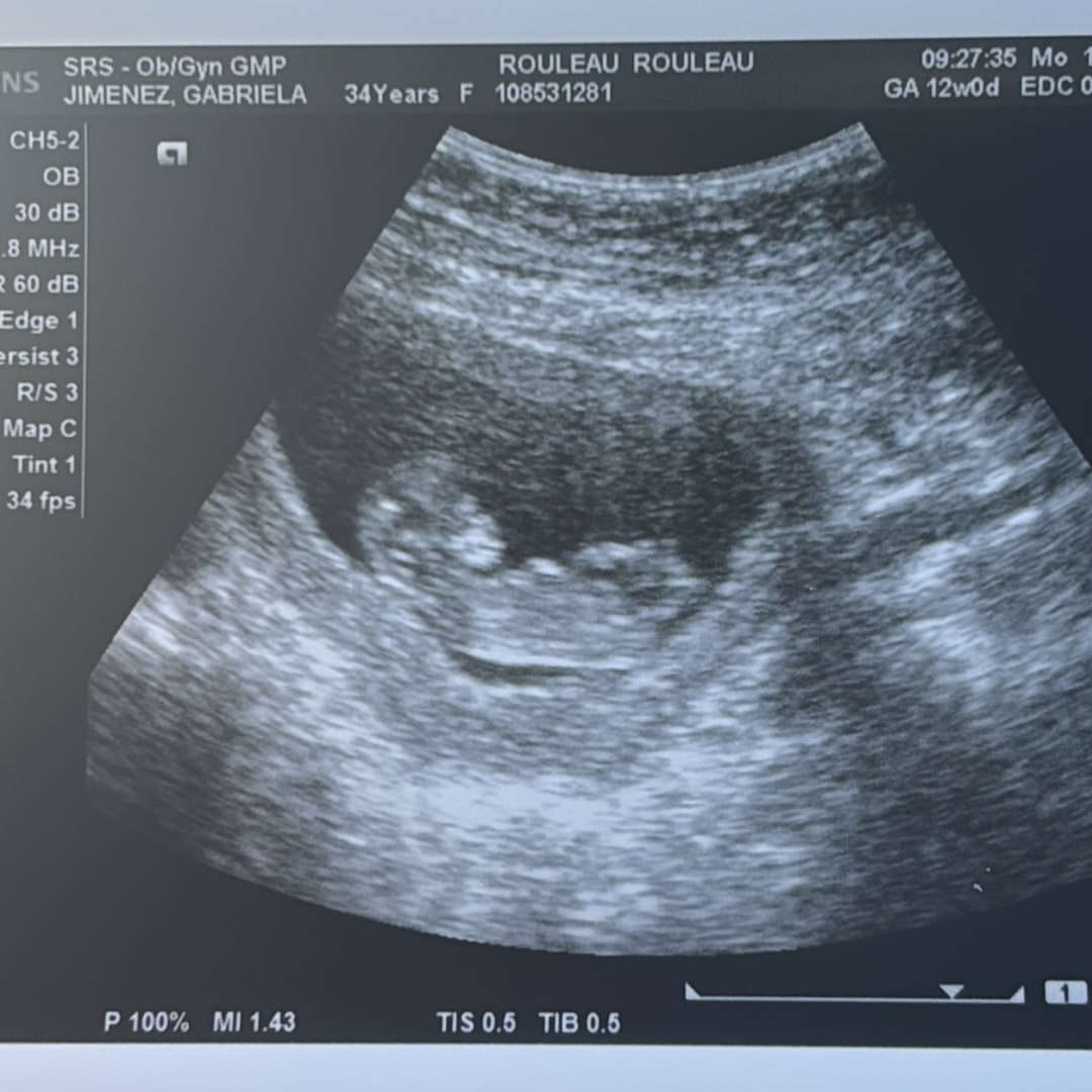 Photo shared by Gabriela for their Babylist baby registry.