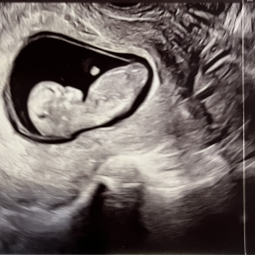 Photo shared by Heather for their Babylist baby registry.