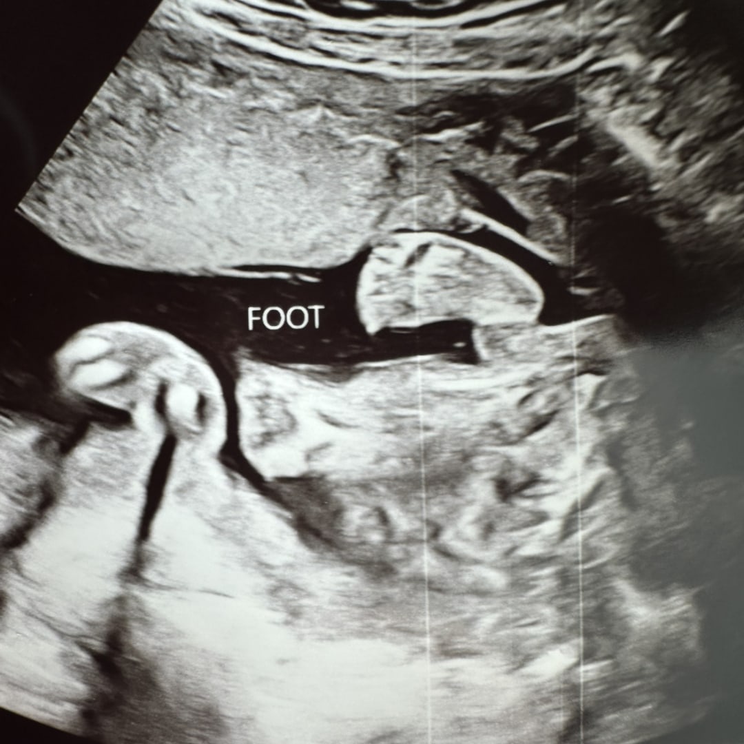 Photo shared by Karla for their Babylist baby registry.