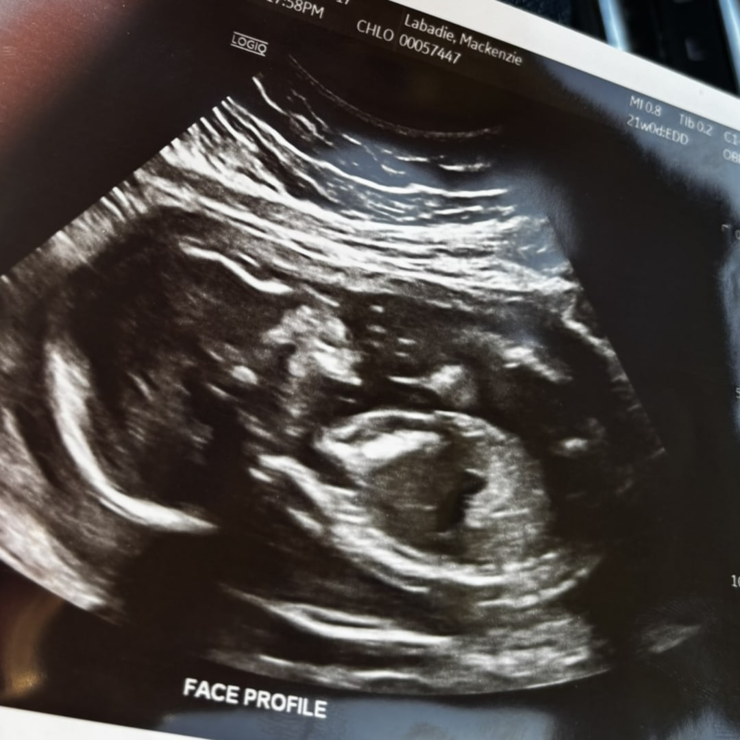 Photo shared by Mackenzie for their Babylist baby registry.