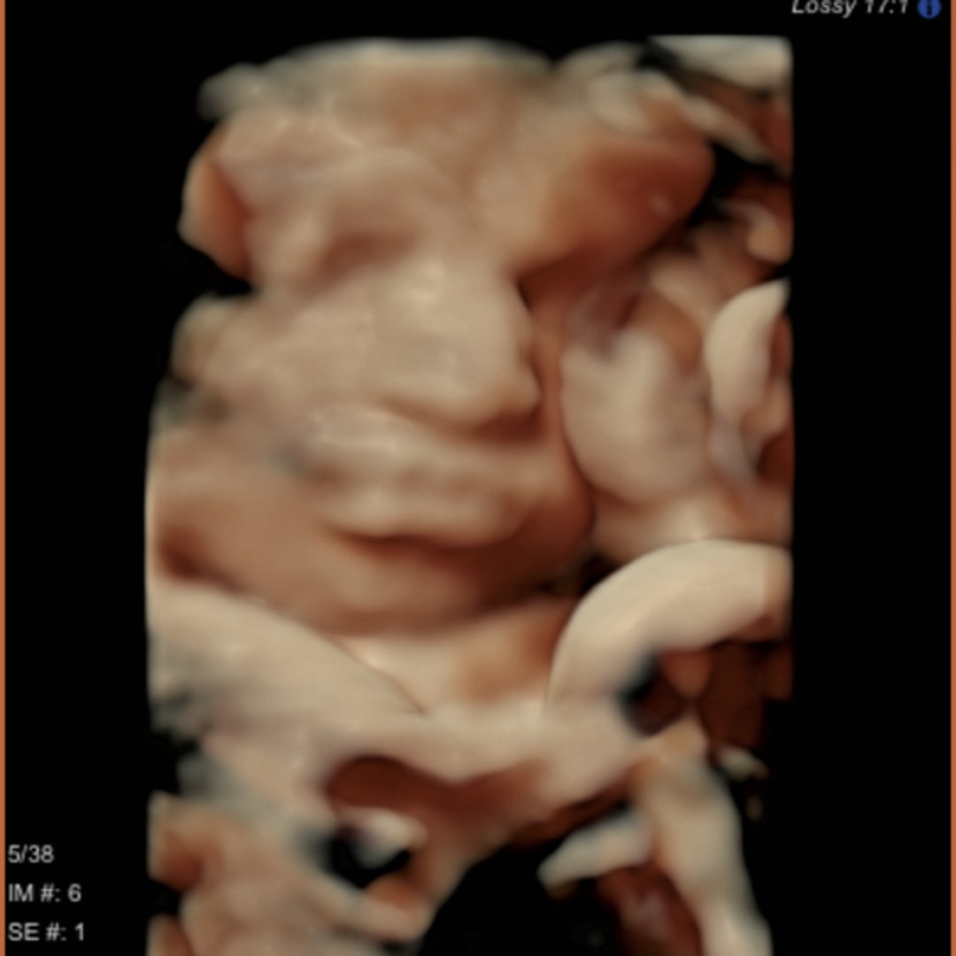 Photo shared by Bri for their Babylist baby registry.