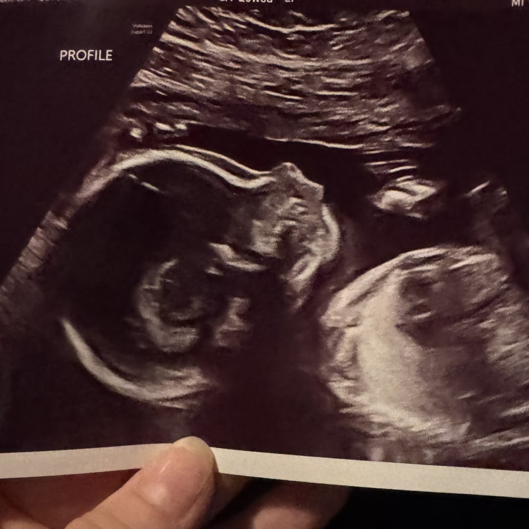 Photo shared by Grant & Kait for their Babylist baby registry.