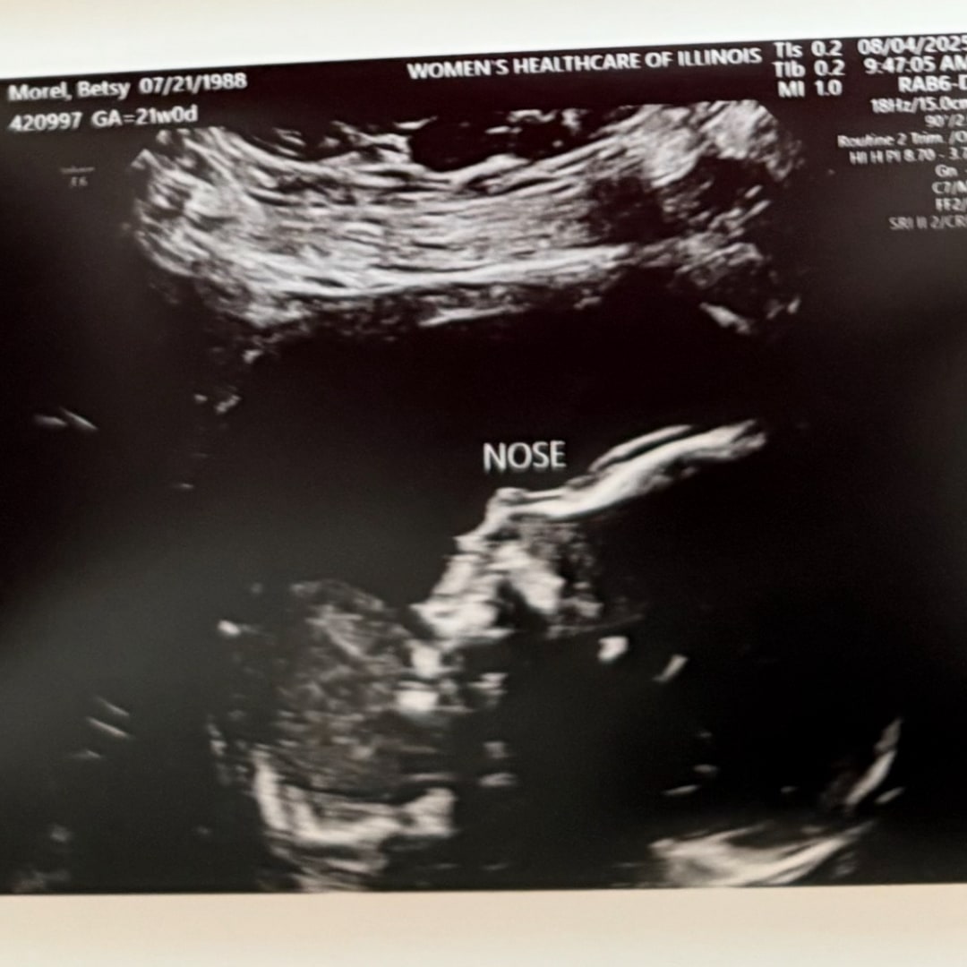 Photo shared by Betsy for their Babylist baby registry.
