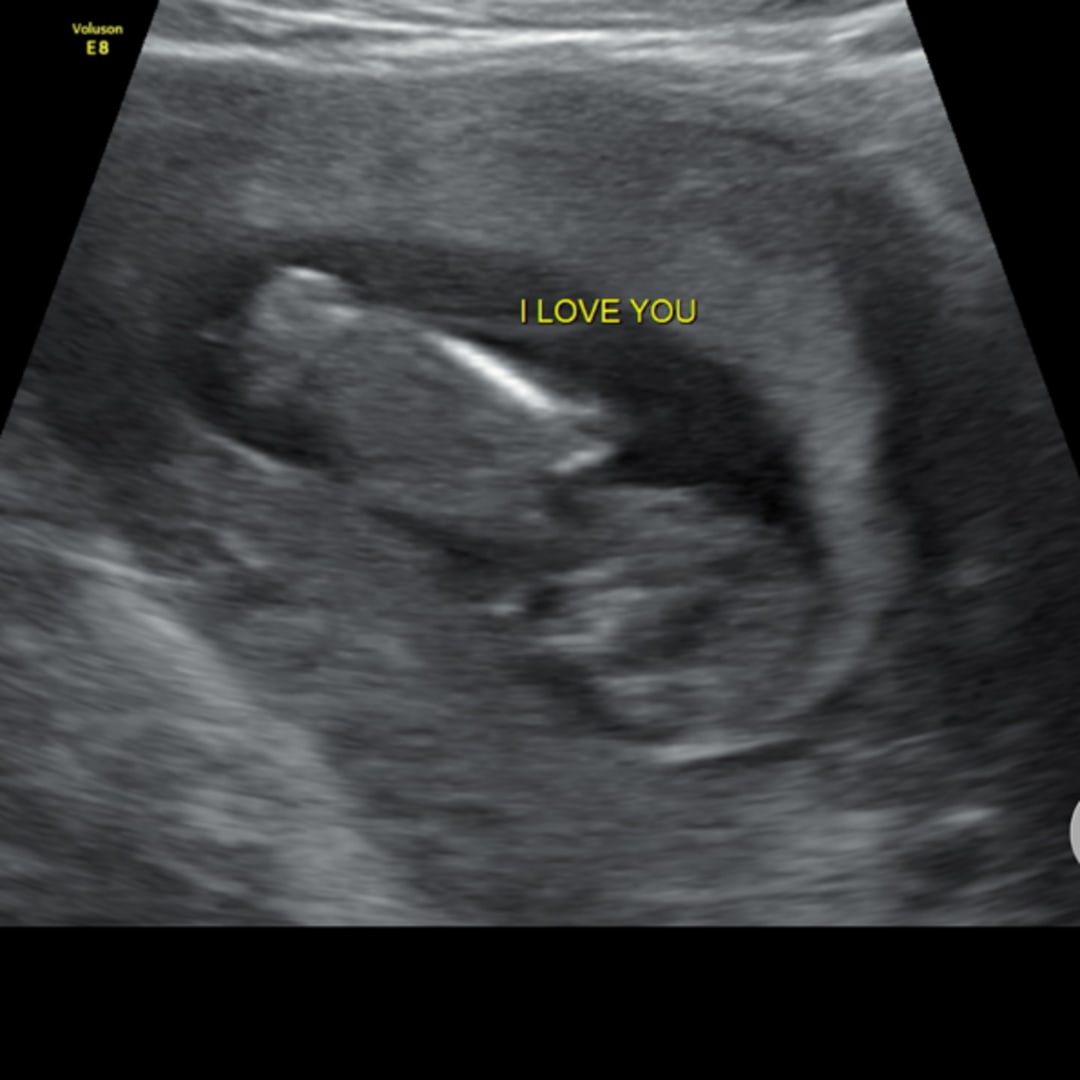 Photo shared by Carlie for their Babylist baby registry.