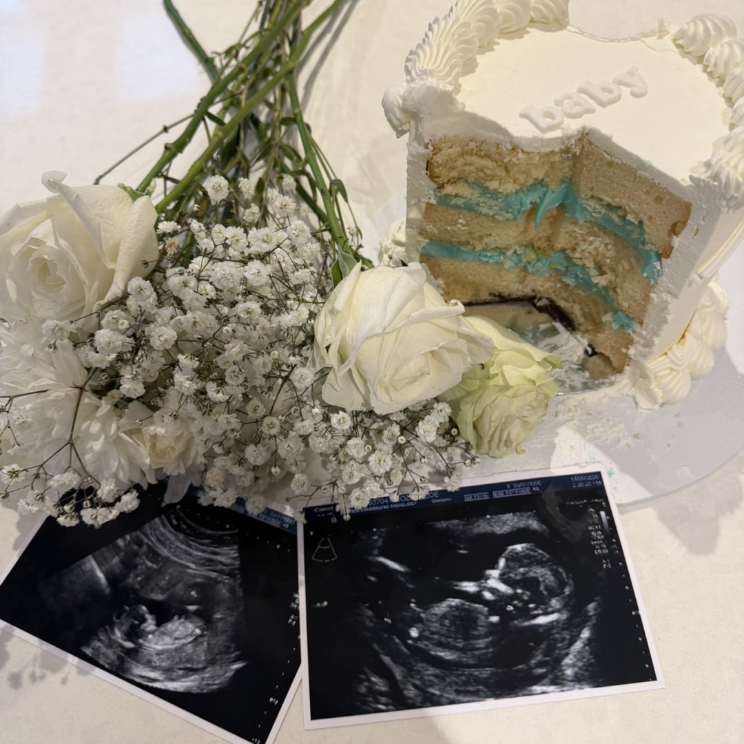 Photo shared by Zoe for their Babylist baby registry.