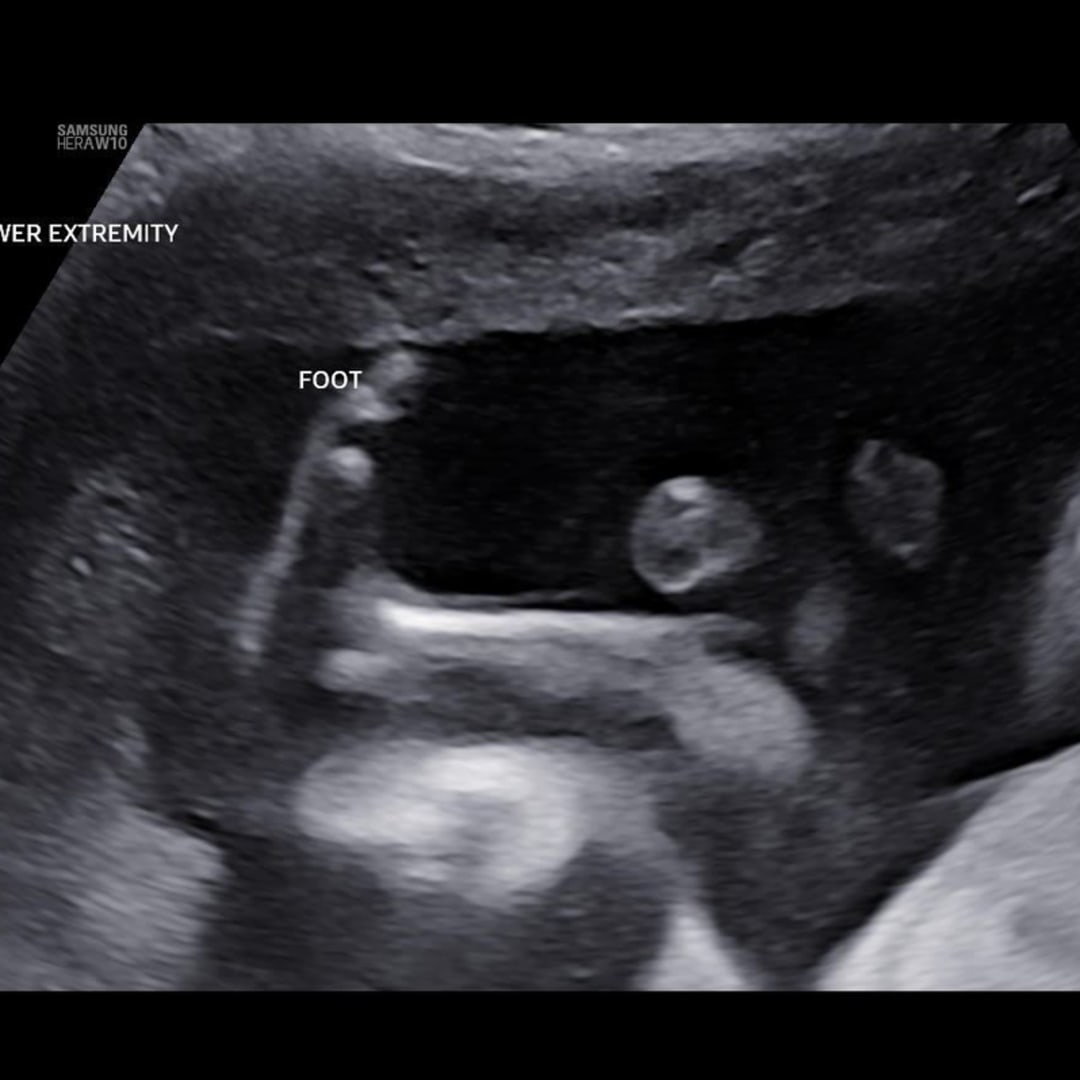Photo shared by Alexia for their Babylist baby registry.