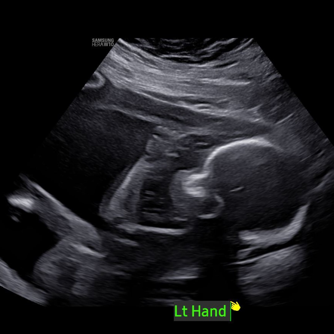 Photo shared by Taylor for their Babylist baby registry.