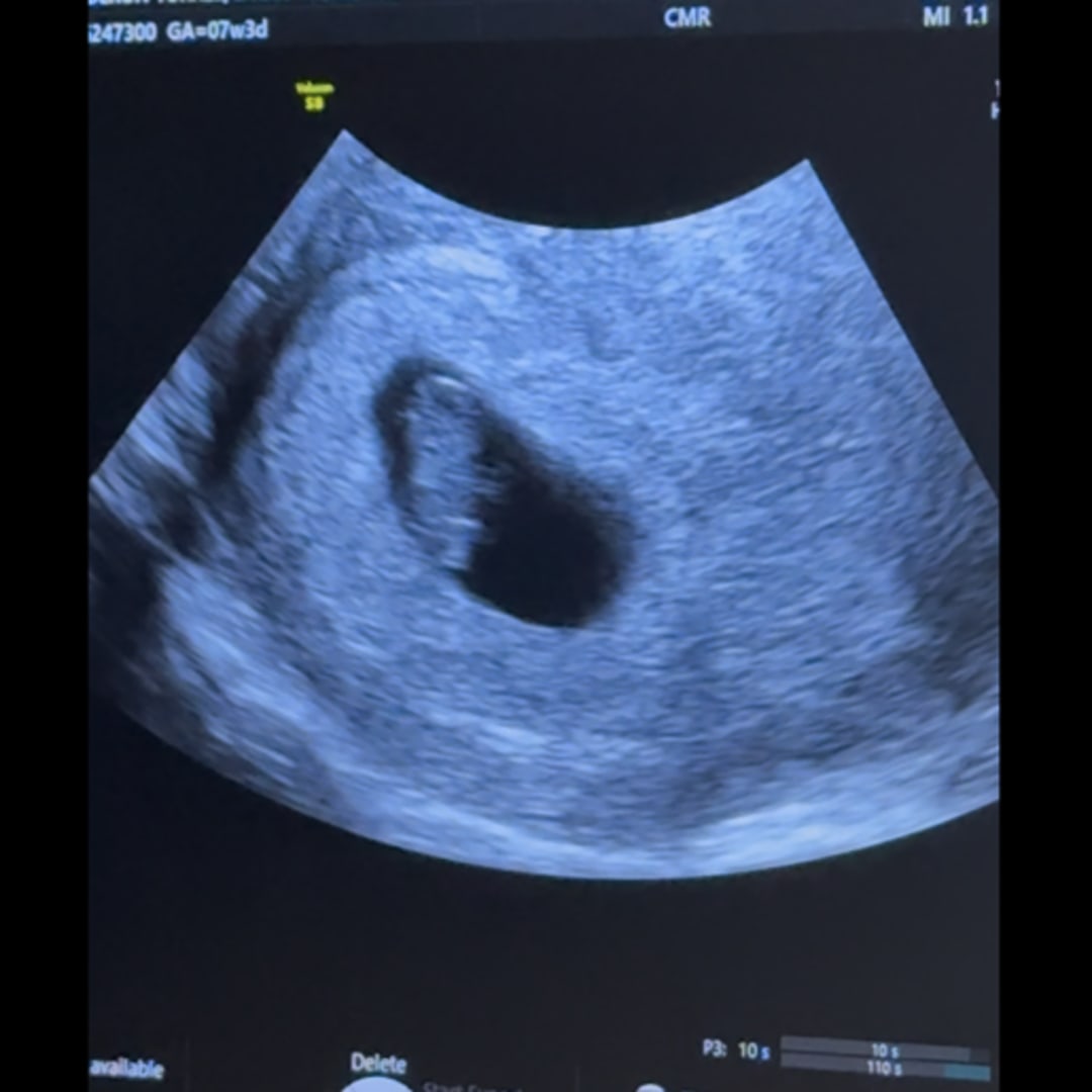 Photo shared by Jamie for their Babylist baby registry.
