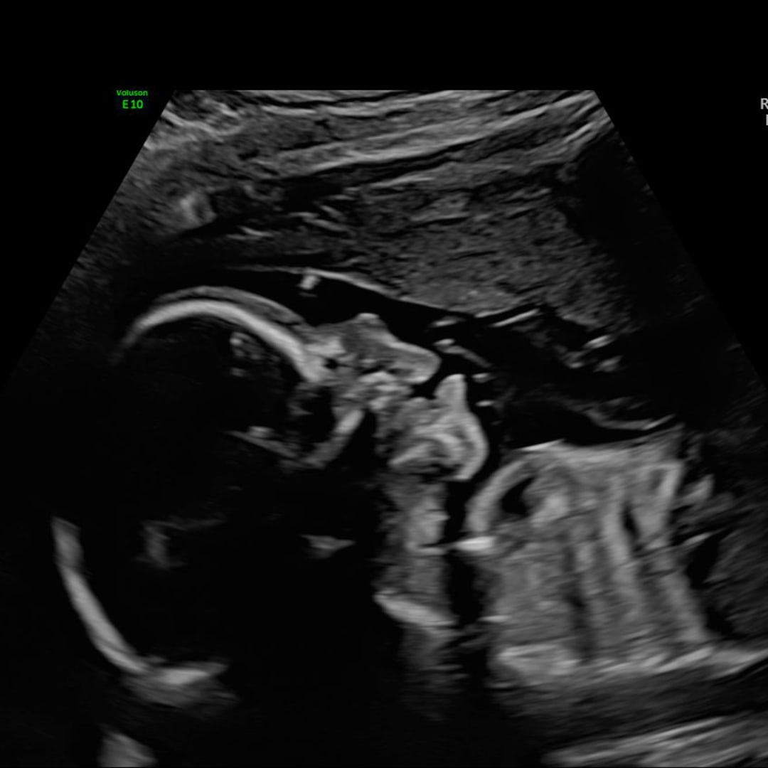 Photo shared by April for their Babylist baby registry.