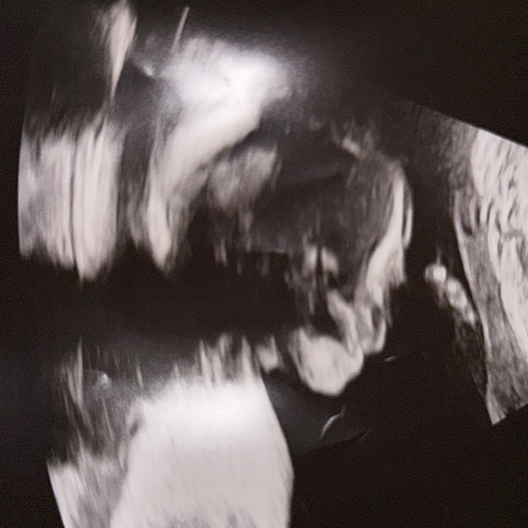Photo shared by ChaseL for their Babylist baby registry.