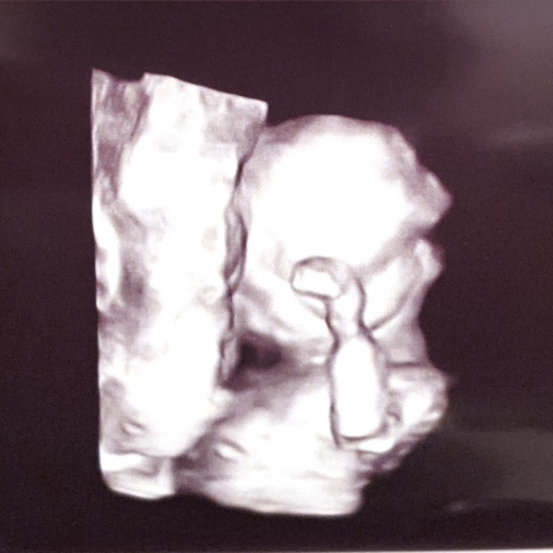 Photo shared by Ashlyn for their Babylist baby registry.