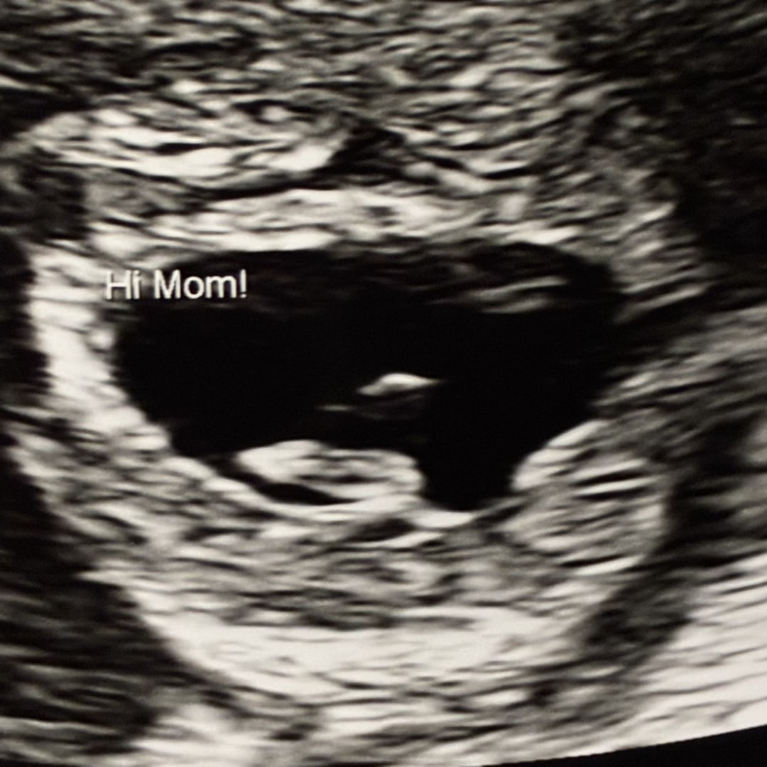 Photo shared by Keitha for their Babylist baby registry.