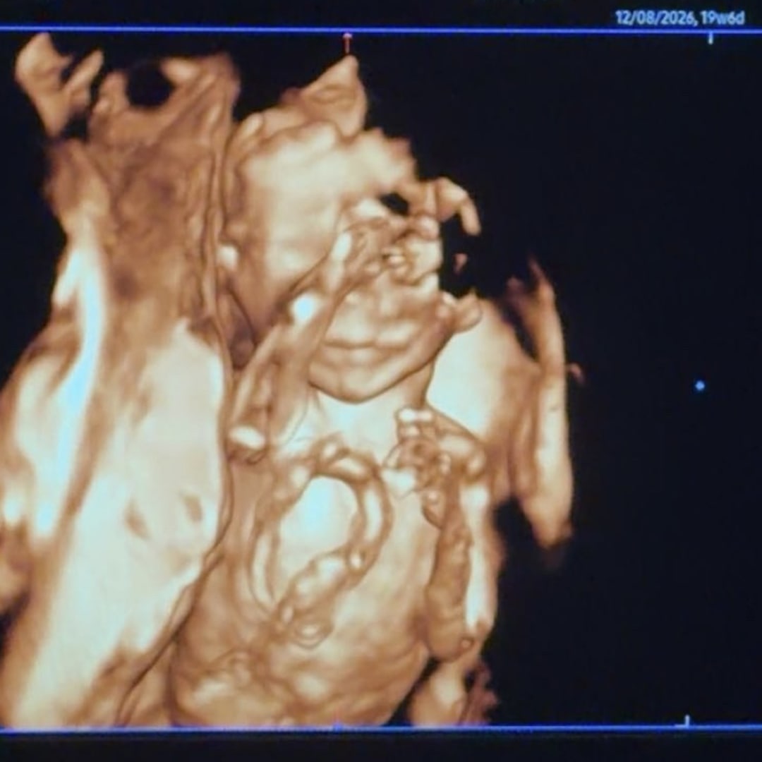 Photo shared by Haley for their Babylist baby registry.