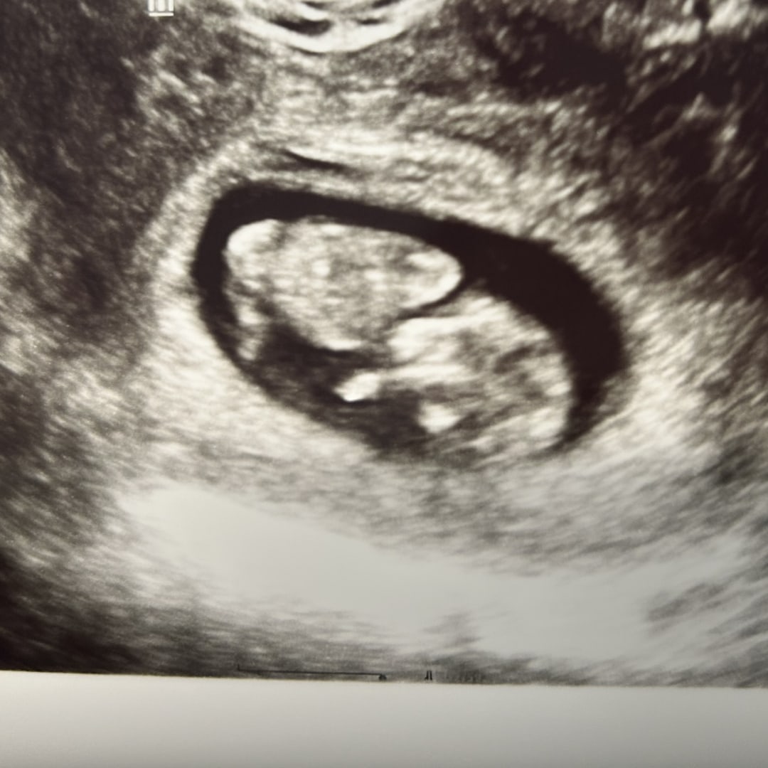 Photo shared by Laura for their Babylist baby registry.