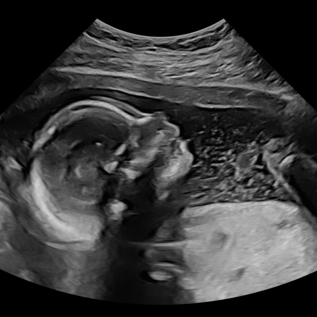 Photo shared by Autum for their Babylist baby registry.