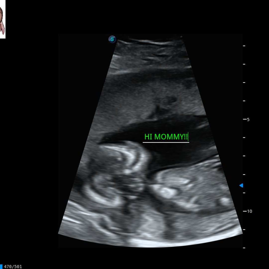 Photo shared by Marielizabeth for their Babylist baby registry.