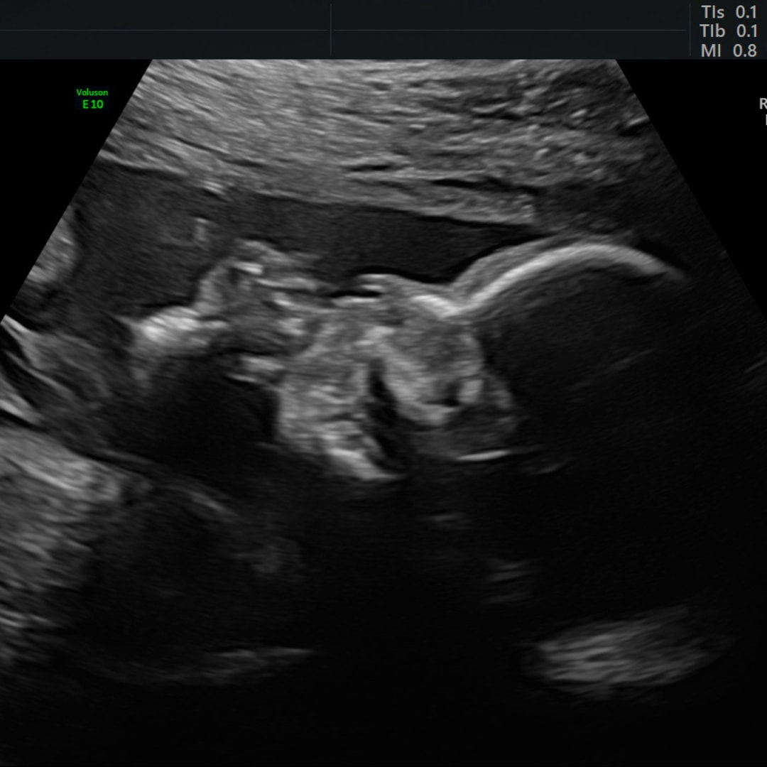 Photo shared by Lexee for their Babylist baby registry.