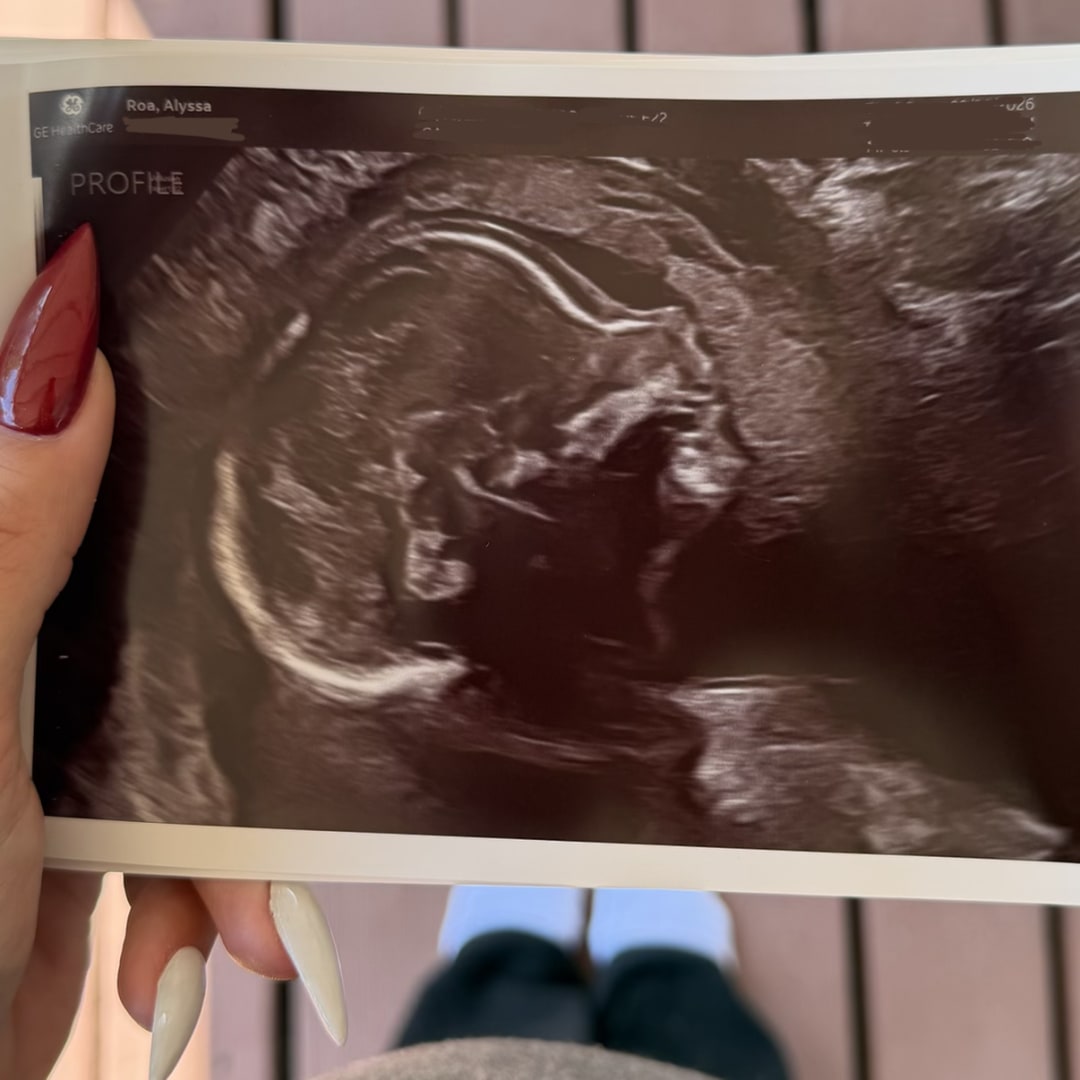 Photo shared by Alyssa for their Babylist baby registry.