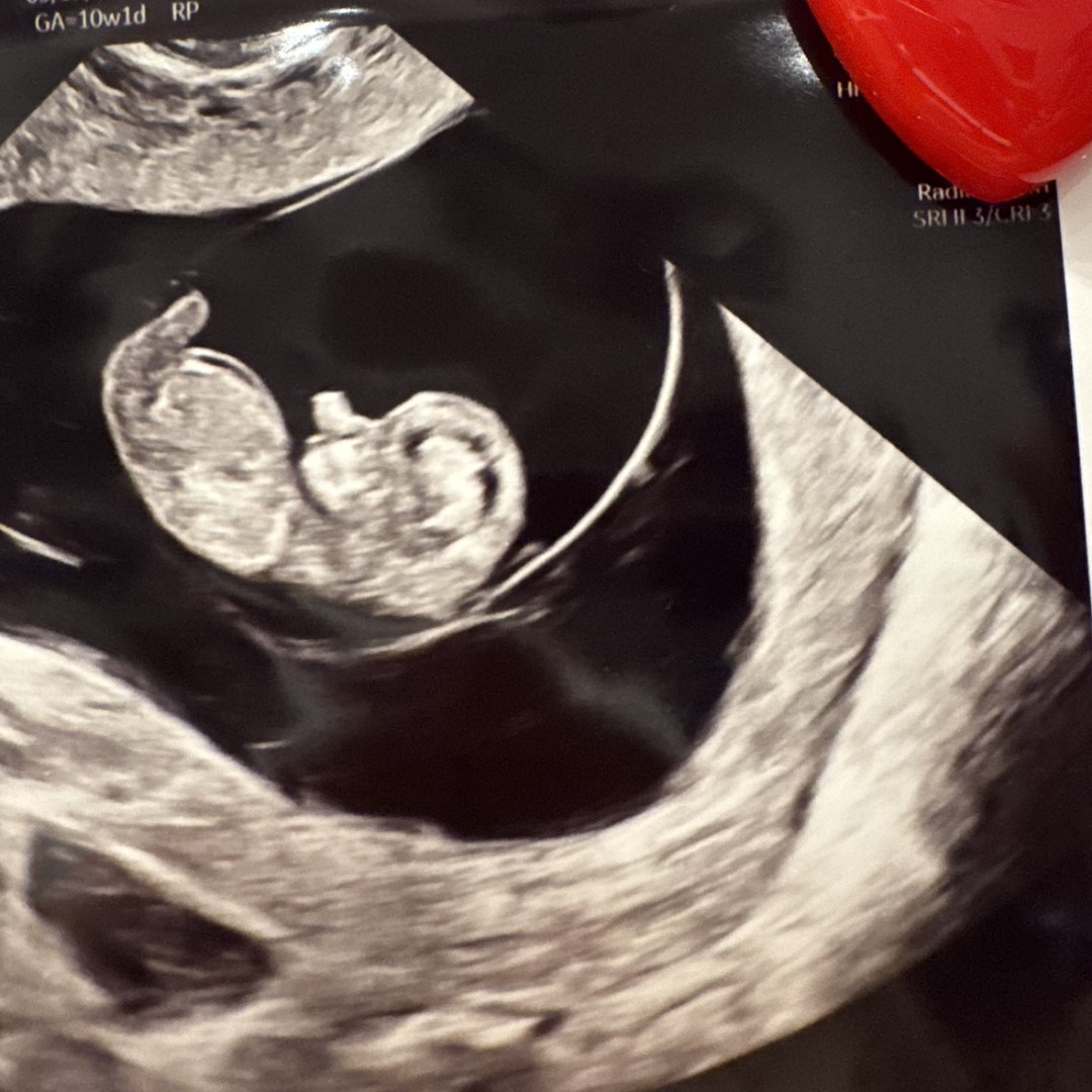 Photo shared by Madison for their Babylist baby registry.