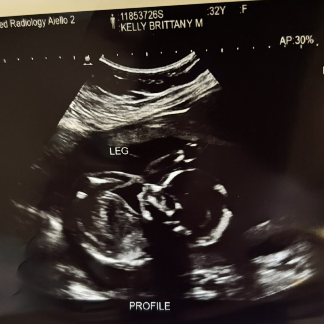Photo shared by Brittany for their Babylist baby registry.