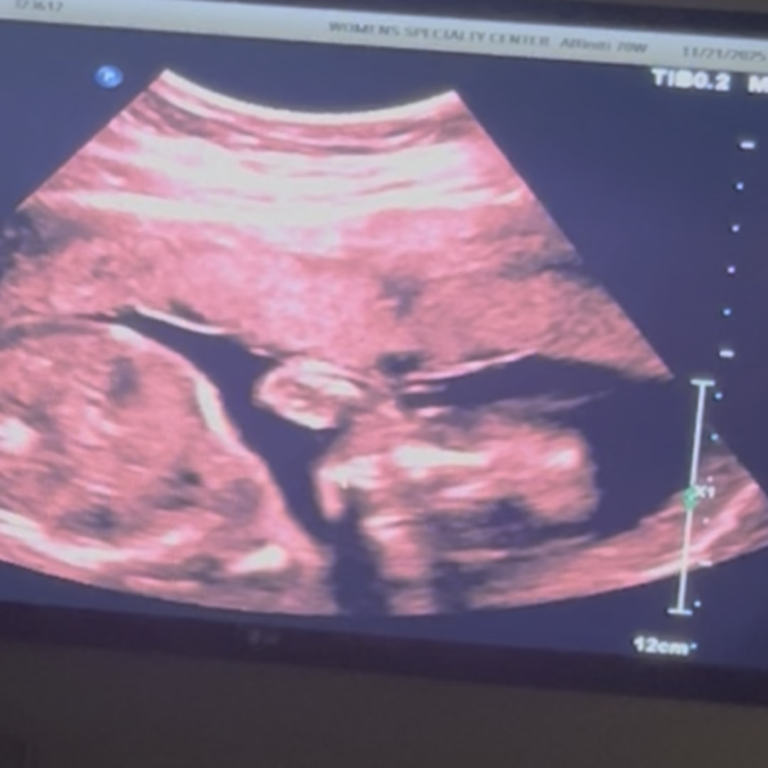 Photo shared by Elizabeth for their Babylist baby registry.